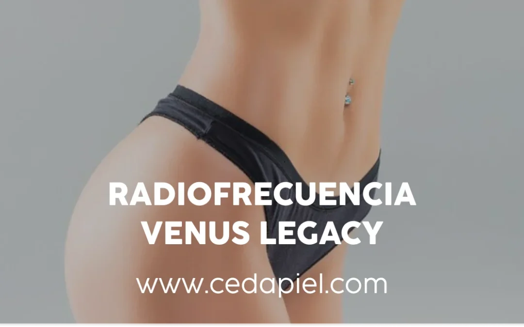 Radiofrecuencia Venus Legacy