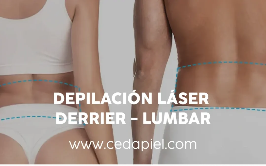 Depilación Láser Derrier – Lumbar