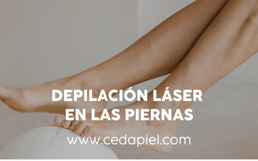 Depilación Láser en las Piernas | Cedapiel | Suavidad Duradera