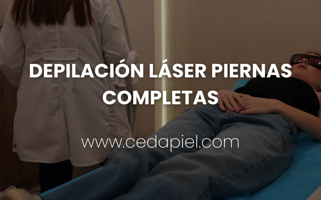 Depilación láser piernas completas