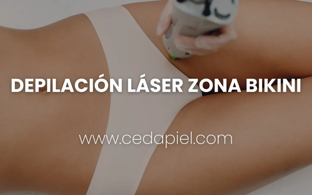 Depilación láser zona bikini