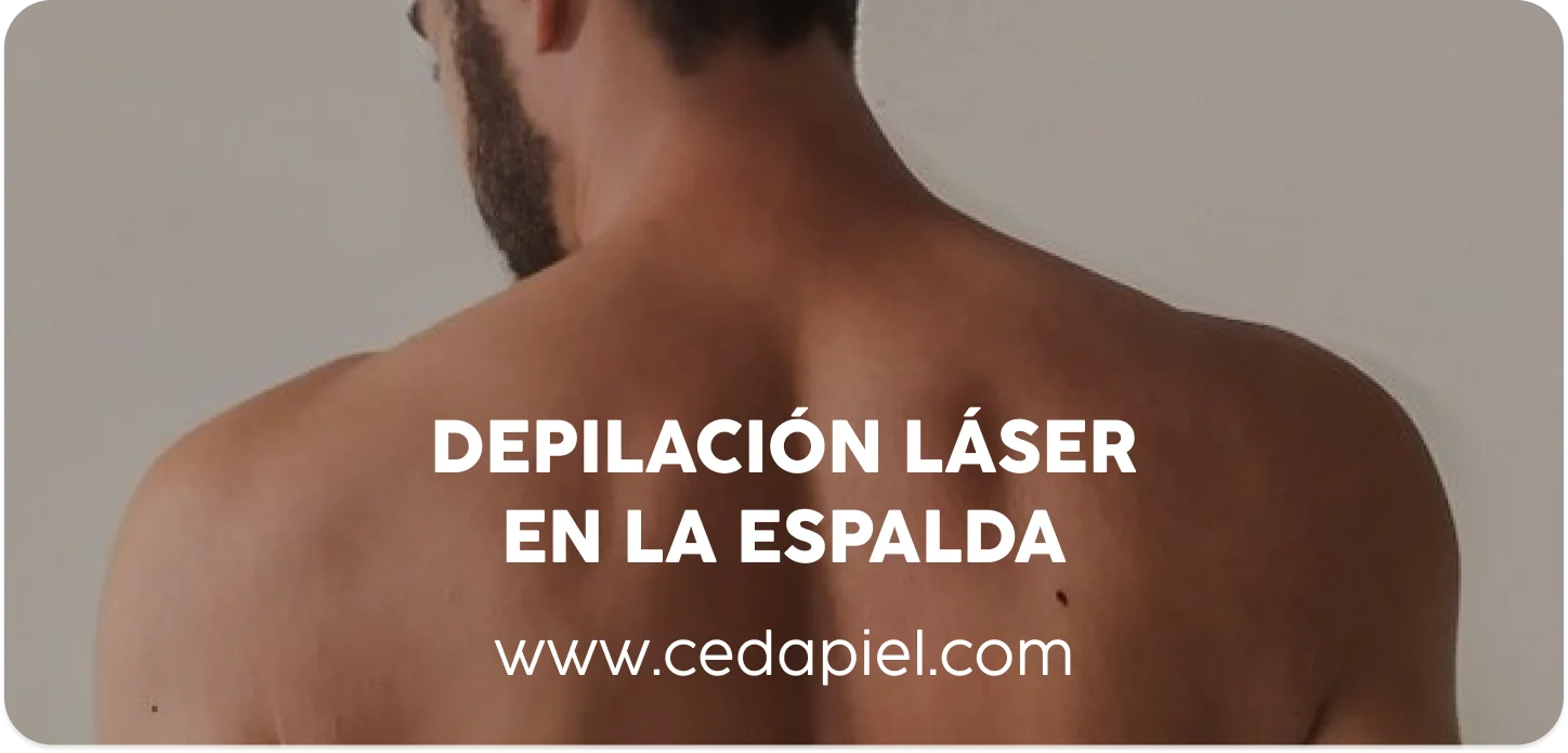 depilacion laser espalda