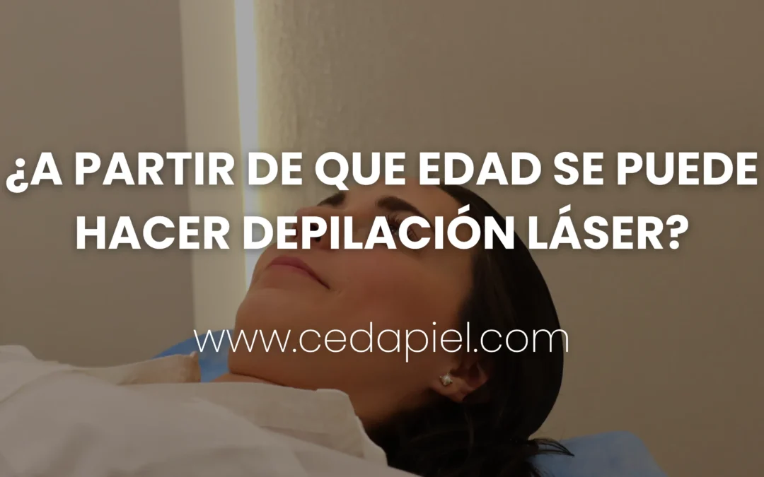 Edad para comenzar con la depilación láser