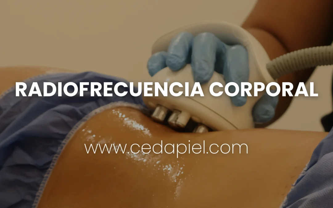 Radiofrecuencia corporal