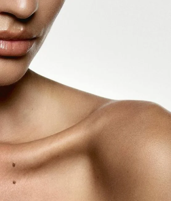 Depilación Láser en el Área Perianal | Higiene y comodidad