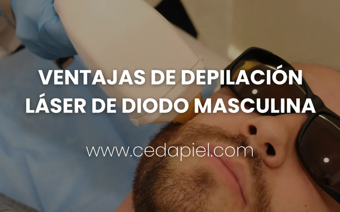 Ventajas de la Depilación Láser Diodo Masculina | Cedapiel