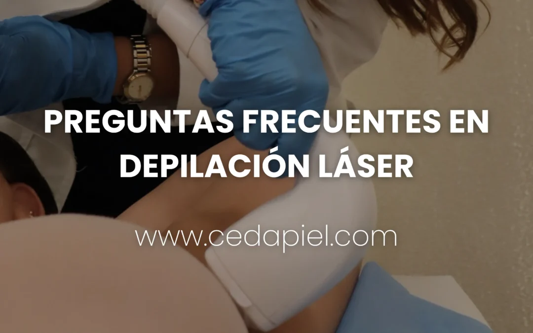 Depilación Láser | 6 Dudas Antes de Tu Primera Sesión | Cedapiel