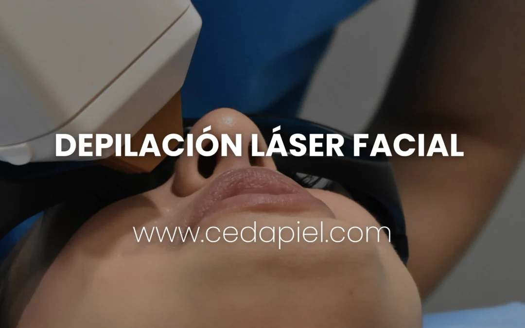 Depilación Láser Facial para Rostro Masculino y Femenino | Cedapiel