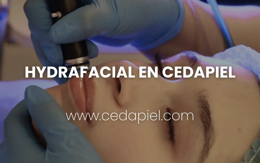 Hydrafacial en Cedapiel | Renueva tu piel desde la primera sesión
