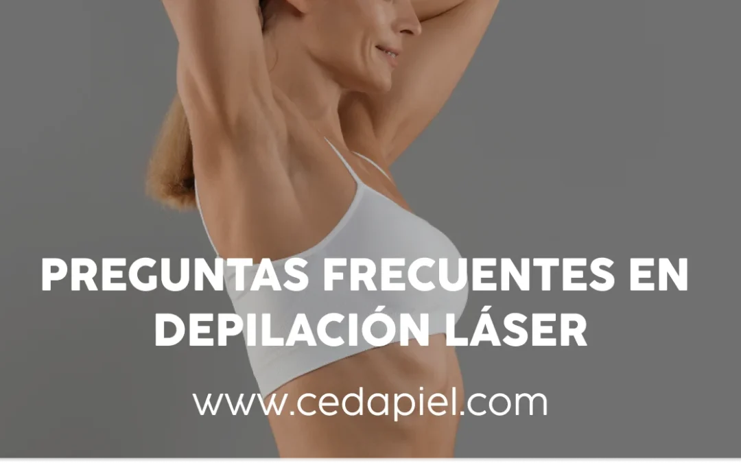 Depilación Láser | 6 Dudas Antes de Tu Primera Sesión | Cedapiel
