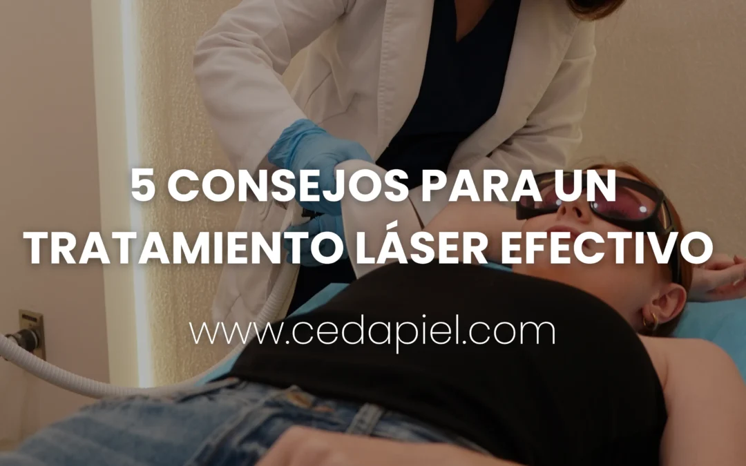 Tratamiento láser | 5 consejos para mejores resultados | Cedapiel