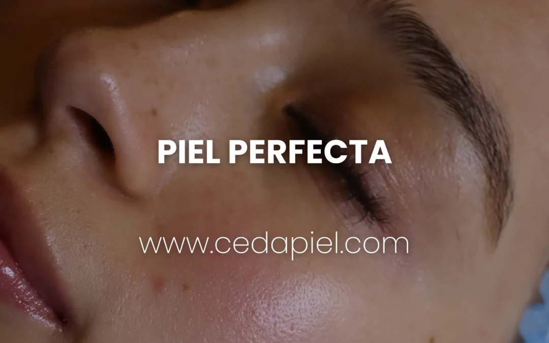 Tratamientos faciales en Monterrey | Tu piel perfecta con Cedapiel