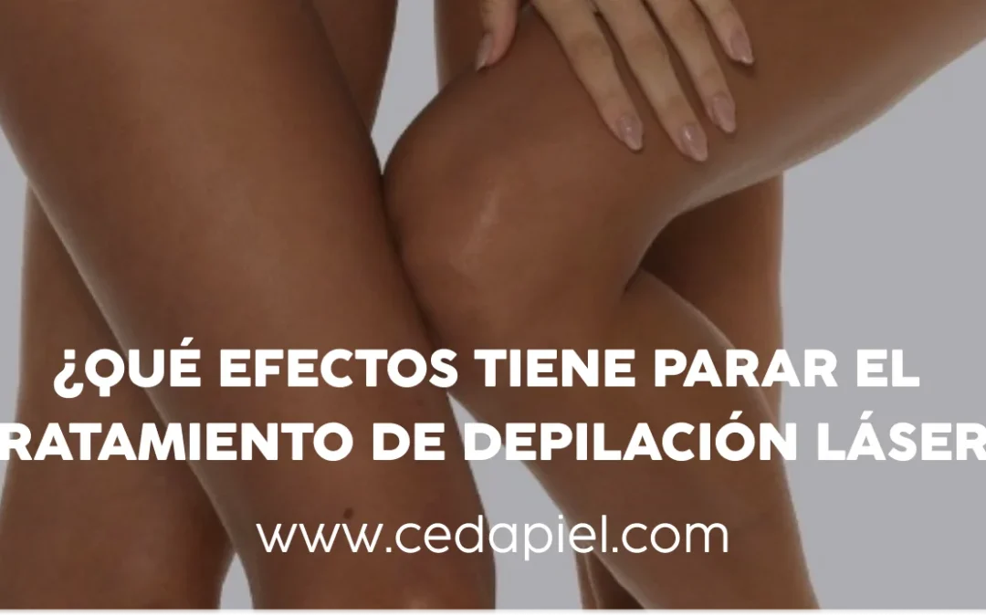 ¿Qué pasa si interrumpes la depilación láser? | Centros Cedapiel