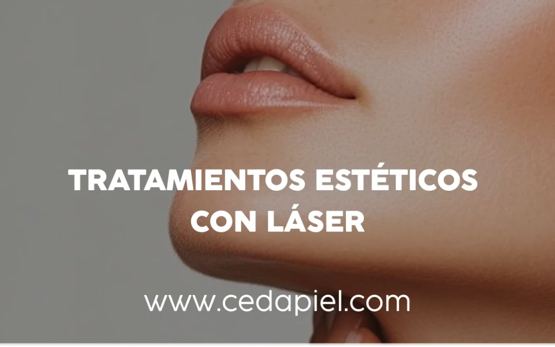 Tratamientos estéticos con láser | Cedapiel Monterrey