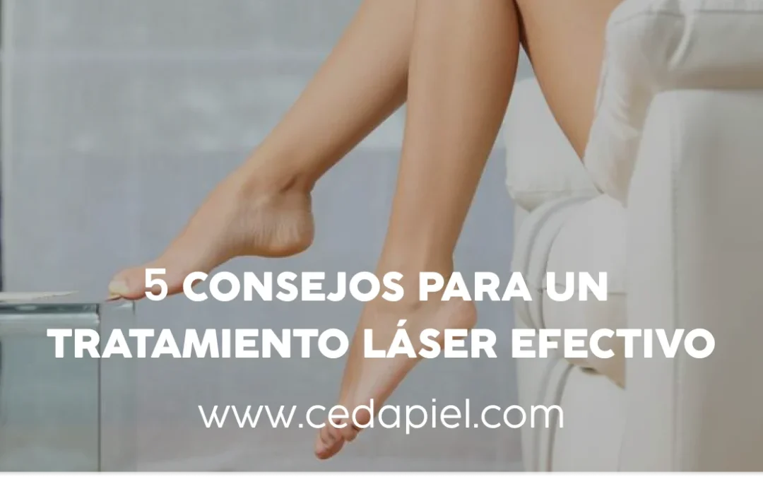 Tratamiento láser | 5 consejos para mejores resultados | Cedapiel