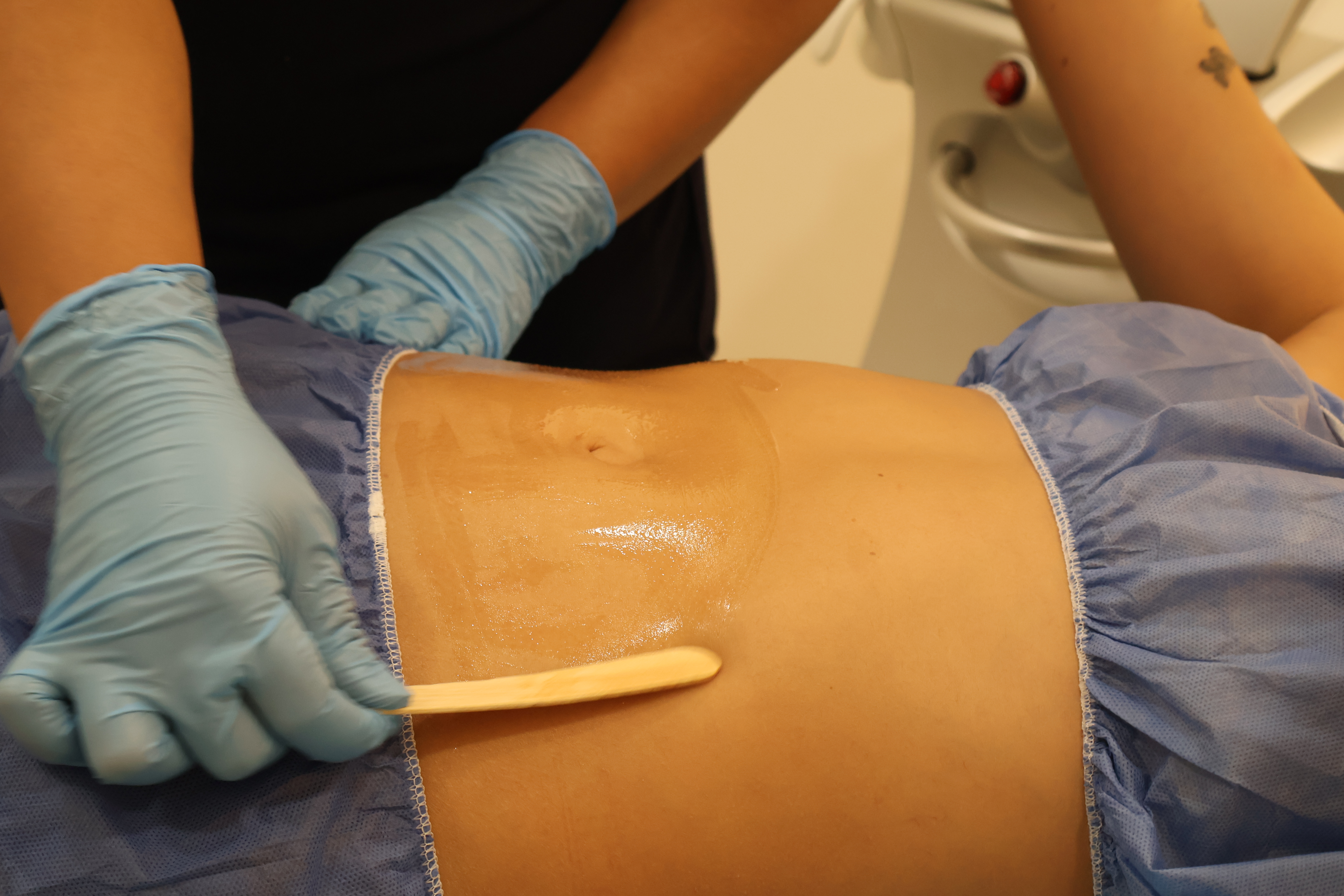 Venus Legacy Cedapiel Monterrey