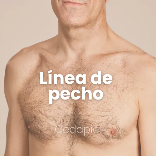 depilación láser linea de pecho cedapiel