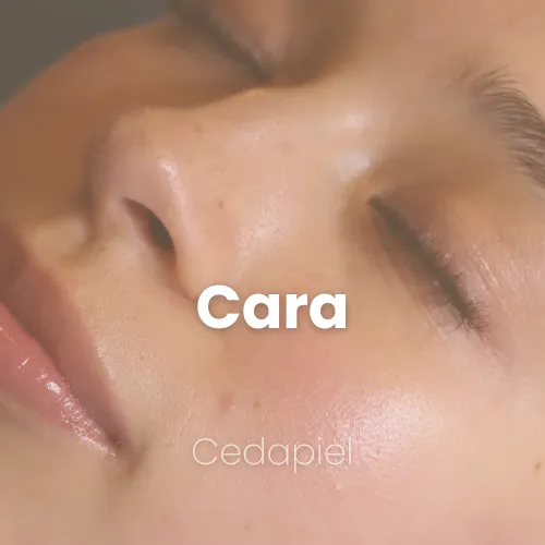 depilación láser cara completa cedapiel