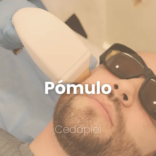 depilacion laser pómulo cedapiel