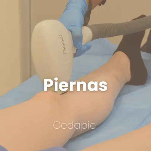 depilación laser de piernas cedapiel
