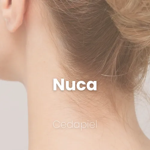 depilación láser de nuca cedapiel