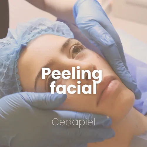 Peeling facial cedapiel