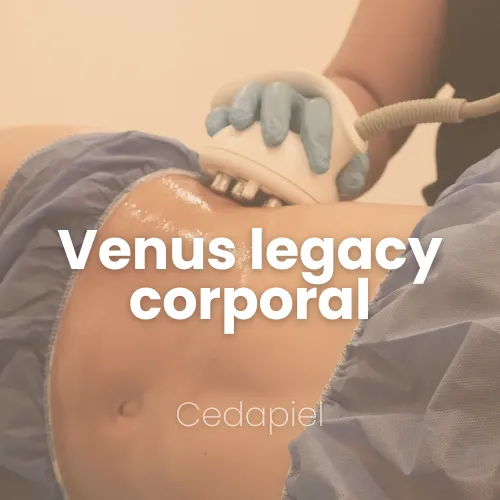 Venus legacy corporal cedapiel