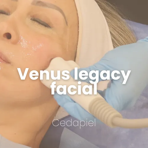 Venus legacy facial cedapiel