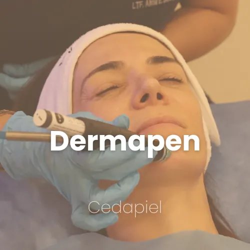 dermapen cedapiel
