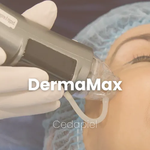 Radiofrecuencia DermaMaxRF