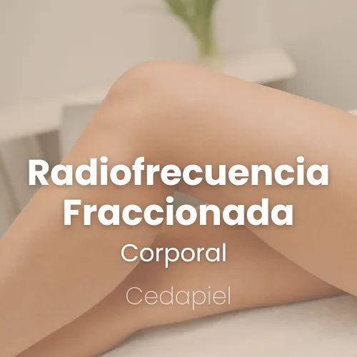 Radiofrecuencia fraccionada