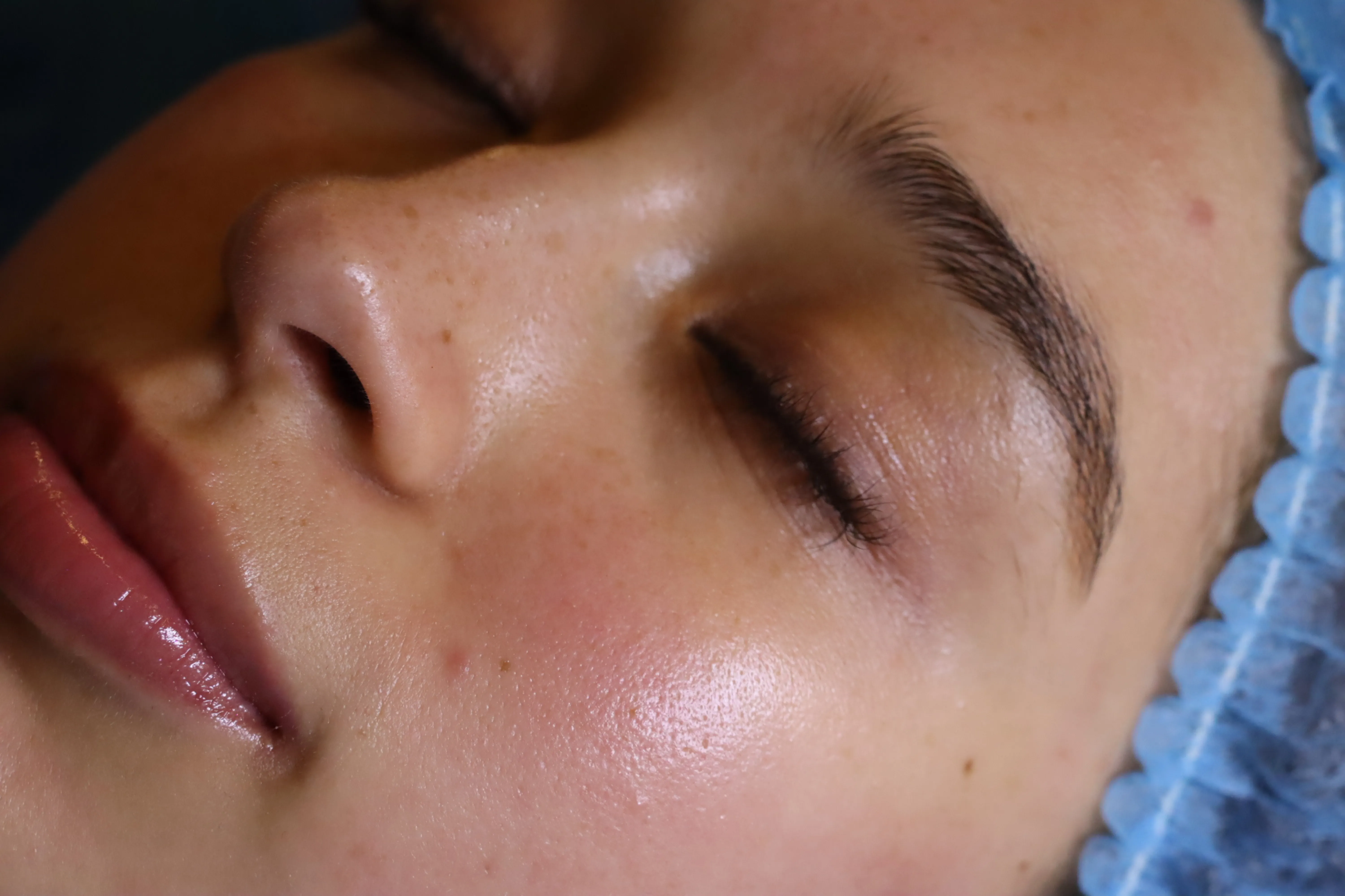 Limpieza facial para piel normal
