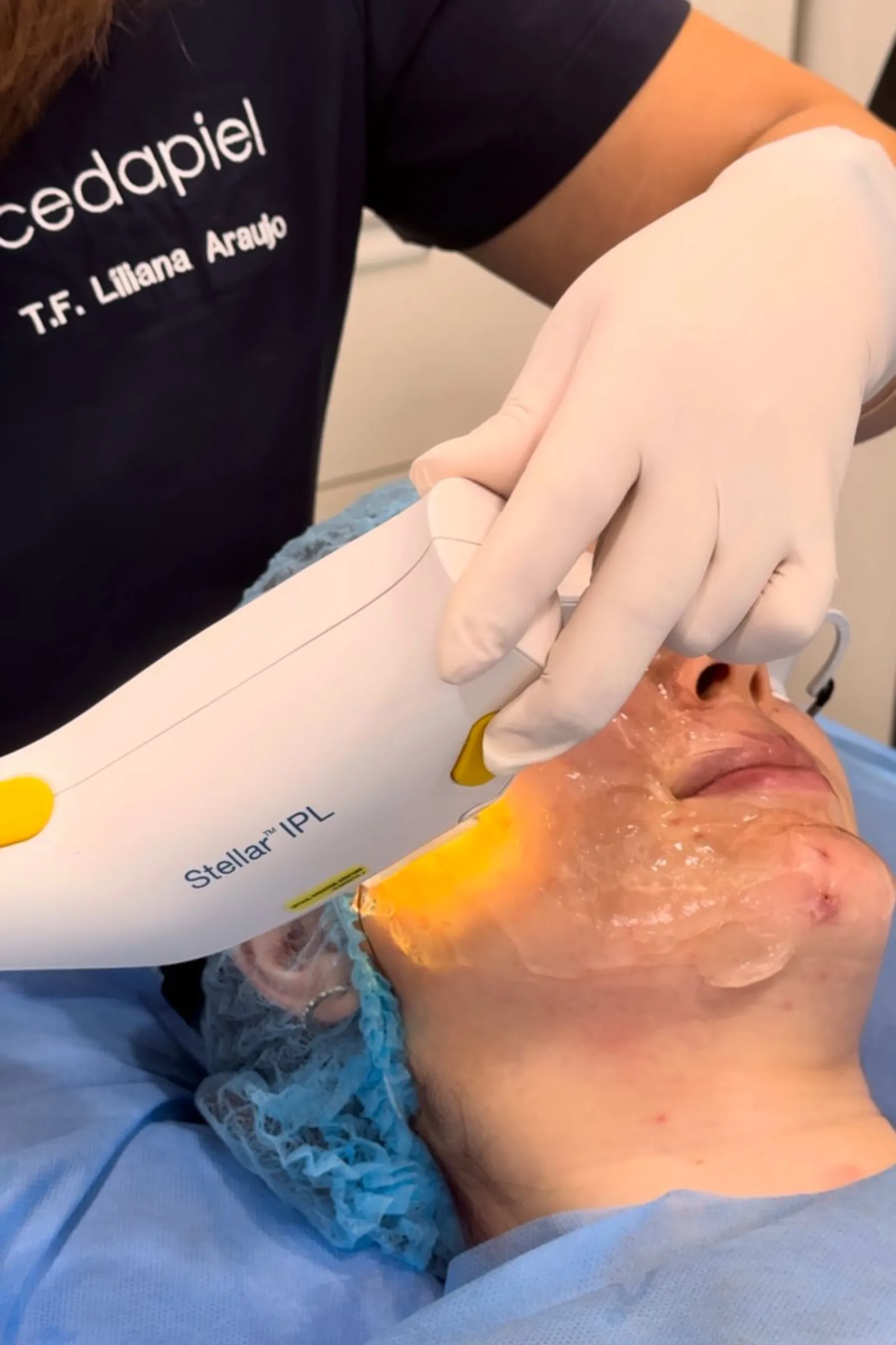 Limpieza facial para piel normal