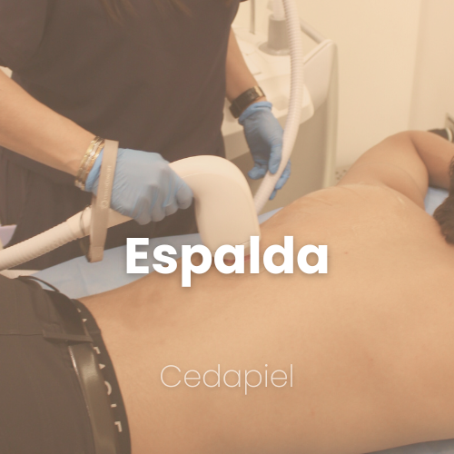 Depilación láser de espalda cedapiel