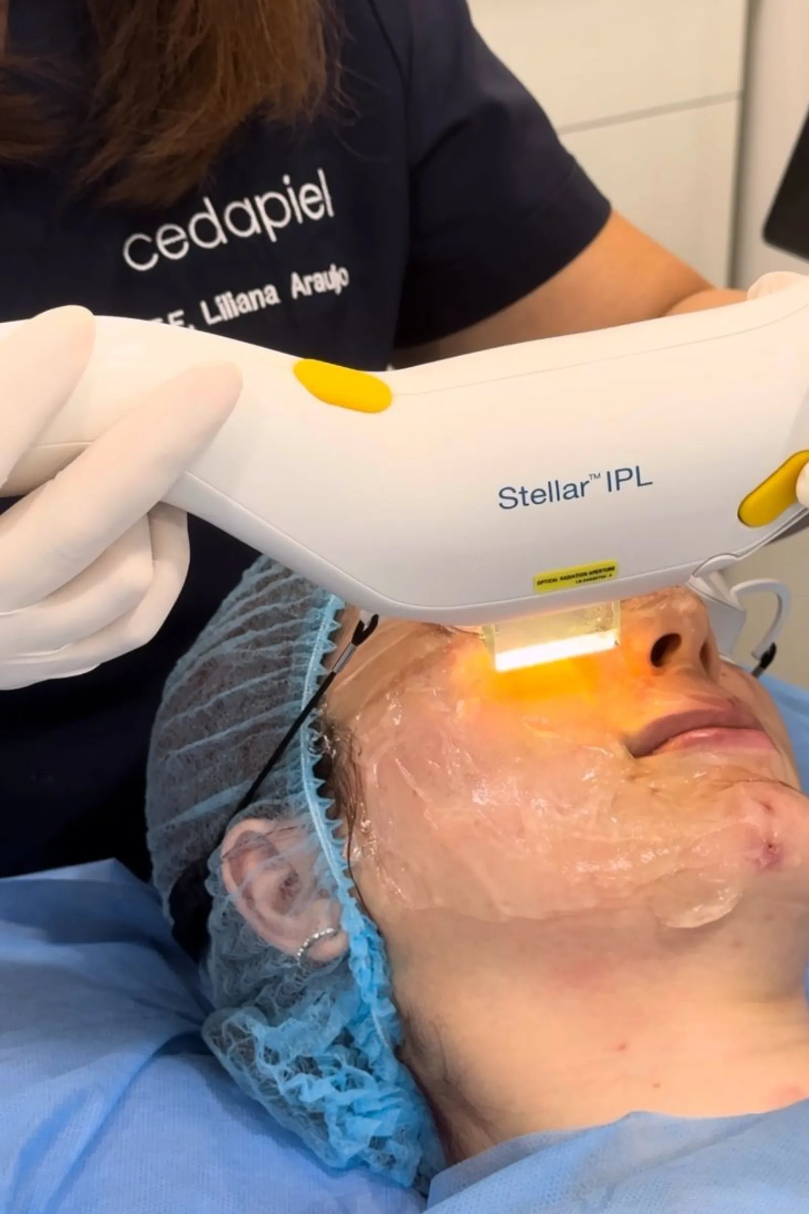 Limpieza facial para piel normal