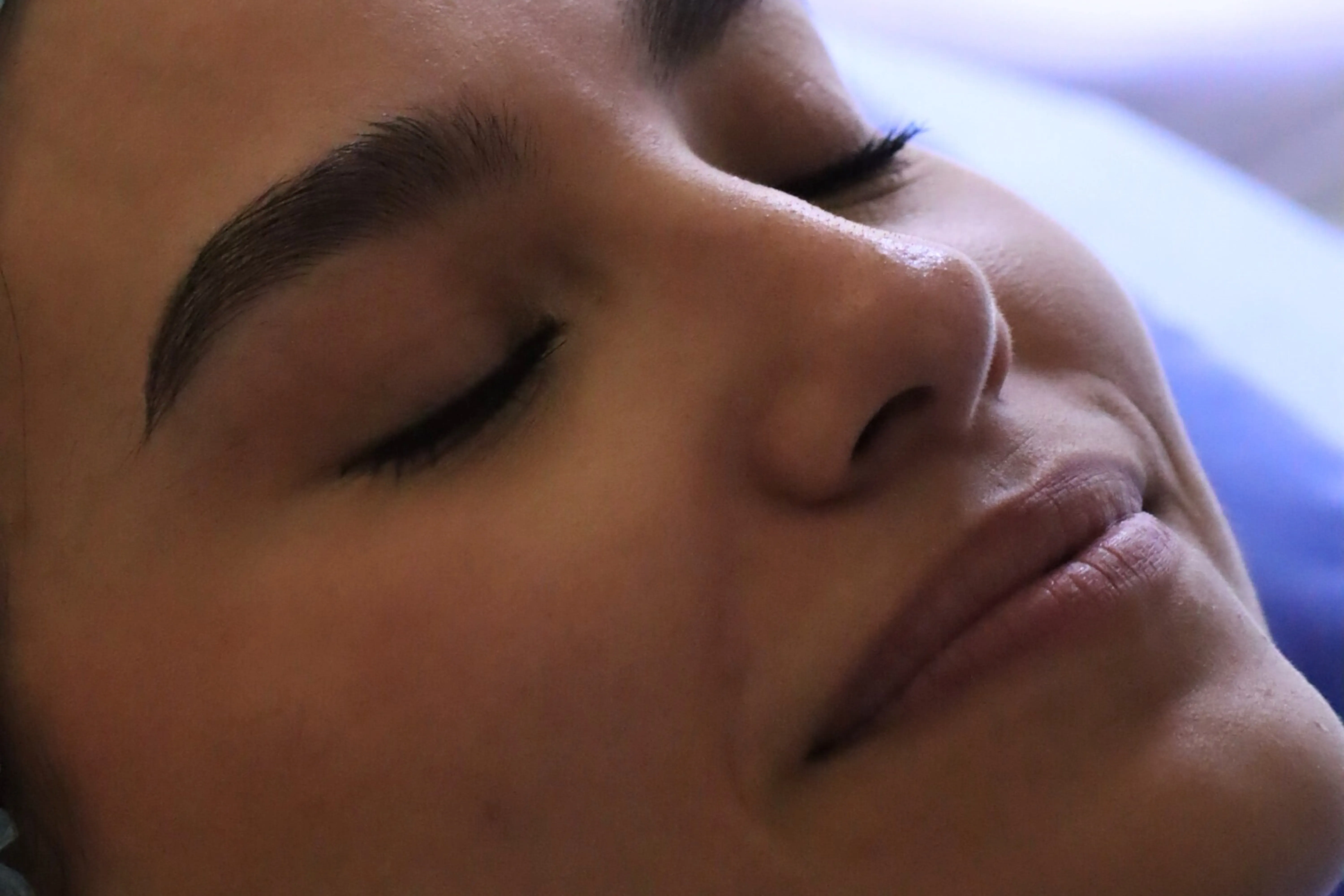 dermapen cedapiel monterrey